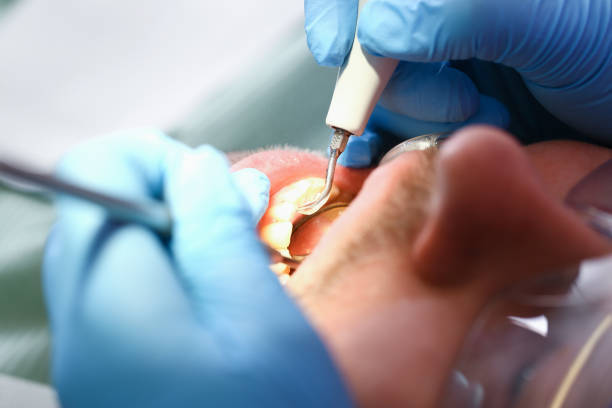 Best Root Canal Emergency Dentist  in Inkerman, PA