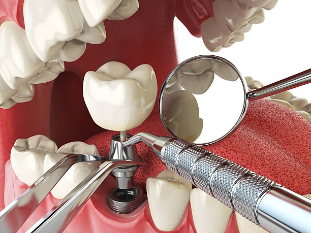 Best Tooth Pain Emergency Relief  in Inkerman, PA